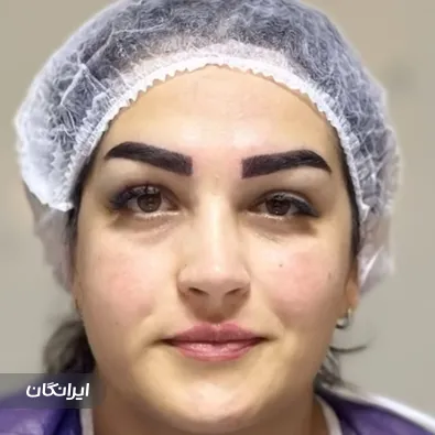 کلینیک کاشت مو مهرآذین