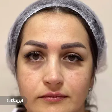 کلینیک کاشت مو مهرآذین