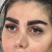 کلینیک کاشت مو مهرآذین