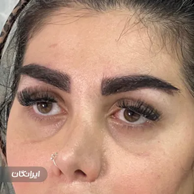 کلینیک کاشت مو مهرآذین