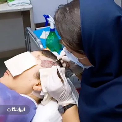 کلینیک کاشت مو جوهری