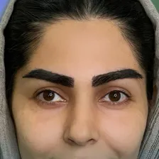 کلینیک کاشت مو بهسیما