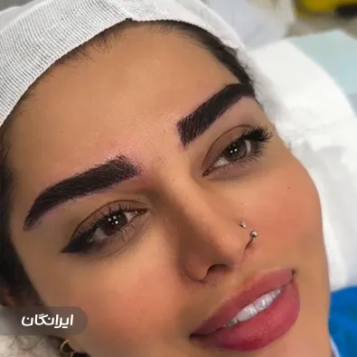 کلینیک کاشت مو پارمین