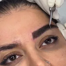 کلینیک کاشت مو پارمین