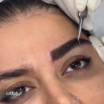 کلینیک کاشت مو پارمین