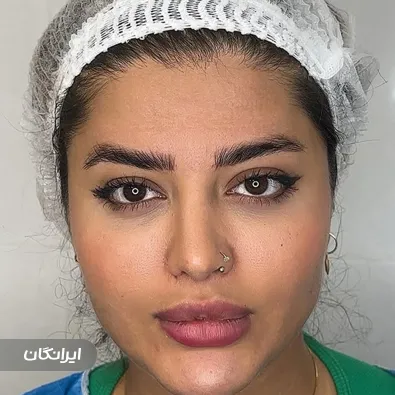 کلینیک کاشت مو پارمین