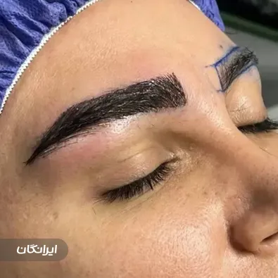 کلینیک زیبایی سیما آرا