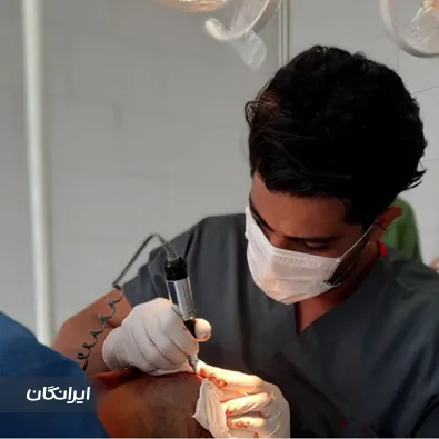 کلینیک کاشت مو آزادی