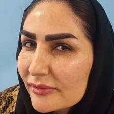 کلینیک کاشت مو کرمی پور