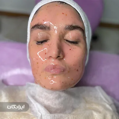 کلینیک زیبایی الیزه