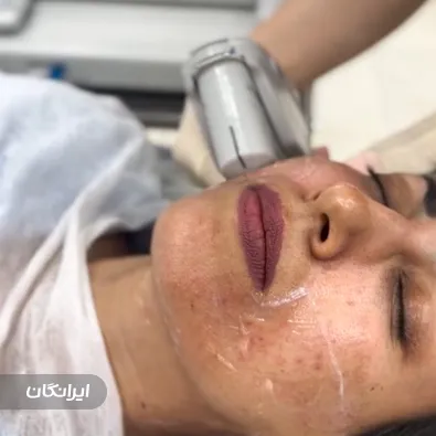 کلینیک زیبایی الیزه