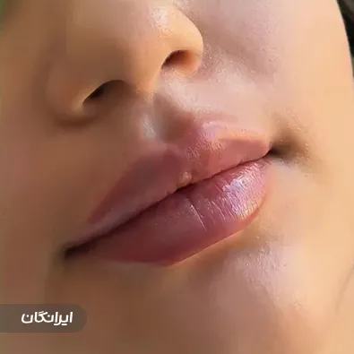 کلینیک زیبایی سنسو