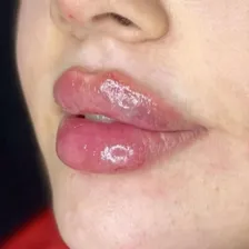 کلینیک زیبایی ونیز