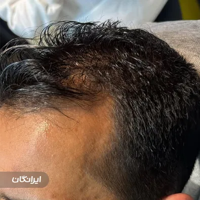 کلینیک زیبایی دکتر زهرا لنکرانی