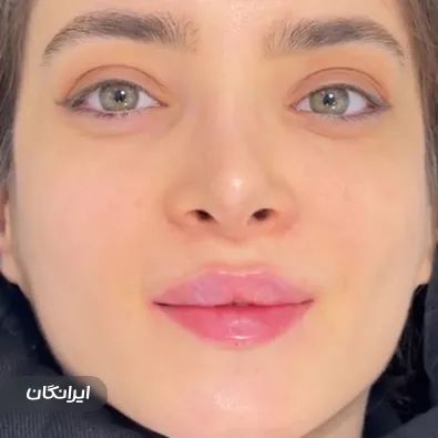 کلینیک زیبایی دکتر ارسطو علیزاده