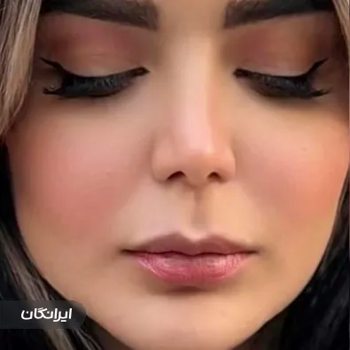 کلینیک زیبایی مهرزاد