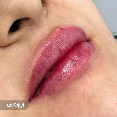 کلینیک زیبایی نیلماه