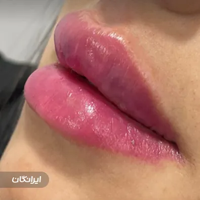 کلینیک زیبایی نیلماه