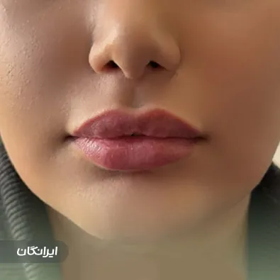 کلینیک زیبایی نیلدا