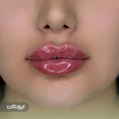 کلینیک زیبایی نیلدا