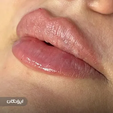 کلینیک زیبایی دکتر محمدمهدی عازم نیا