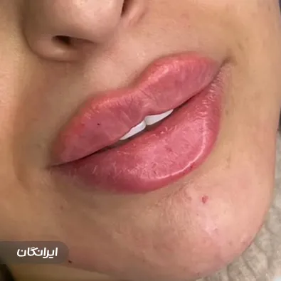 کلینیک زیبایی مرمر