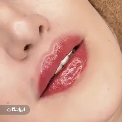 کلینیک زیبایی مرمر