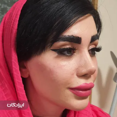 کلینیک زیبایی تینا