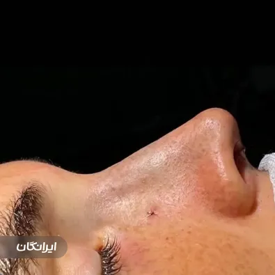 کلینیک جراحی آکای