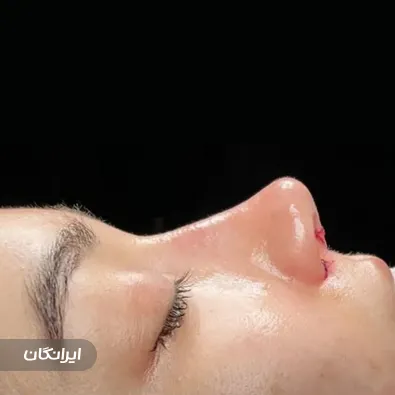 کلینیک جراحی آکای