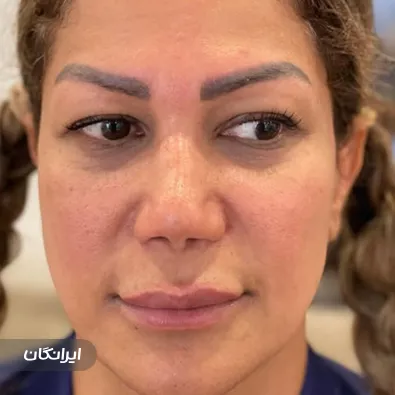 کلینیک زیبایی دکتر کورش بزرگ ساوجی