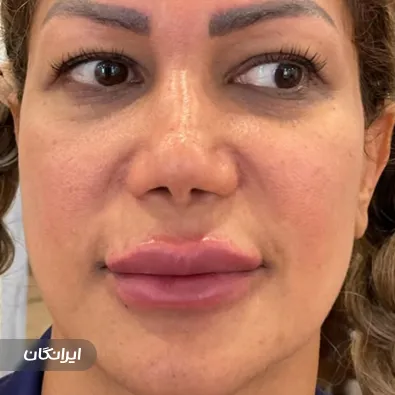 کلینیک زیبایی دکتر کورش بزرگ ساوجی