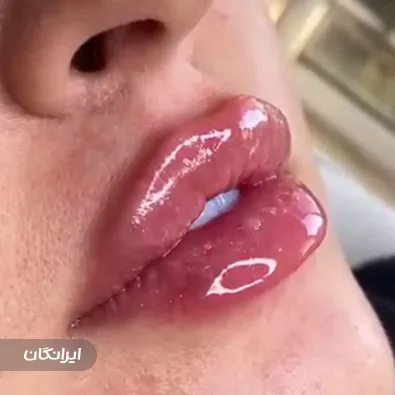 کلینیک زیبایی دکتر سعید مومنی