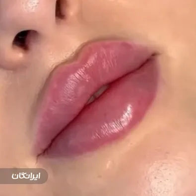 کلینیک زیبایی دکتر سعید مومنی