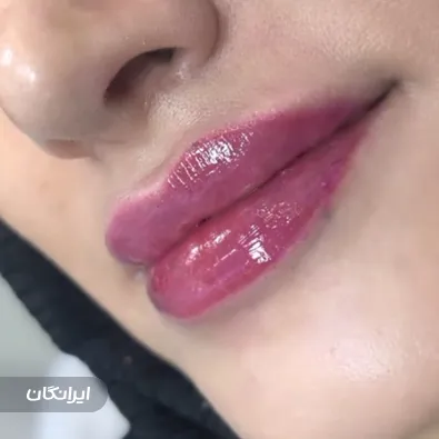 کلینیک زیبایی نیکسیما