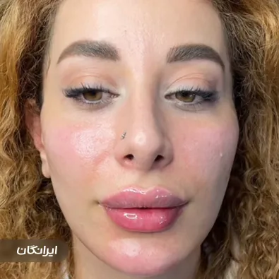 کلینیک زیبایی نی وانی