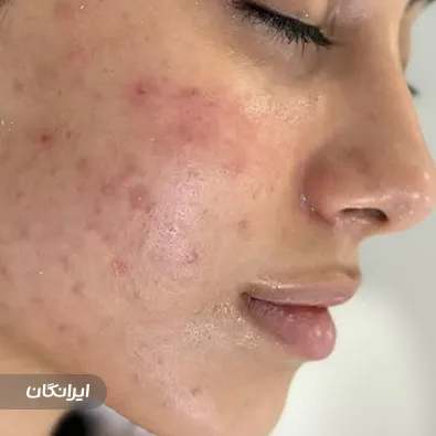 مرکز خدمات پوستی نکیسا