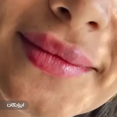 کلینیک زیبایی دی