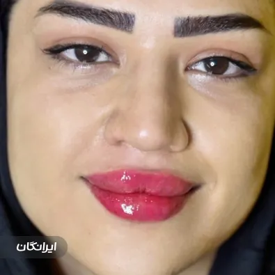 کلینیک زیبایی آیسان