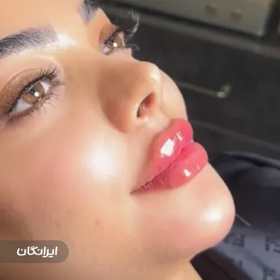 کلینیک زیبایی آیسان