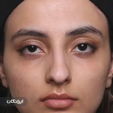 دکتر کیوان اخترکاوان