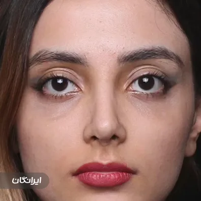 دکتر کیوان اخترکاوان