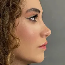 دکتر کیوان اخترکاوان