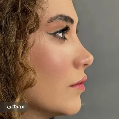 دکتر کیوان اخترکاوان