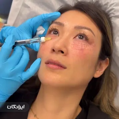 کلینیک زیبایی دیاموند