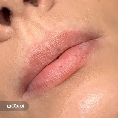 کلینیک زیبایی الیزابت