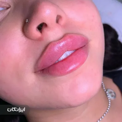 کلینیک زیبایی محا