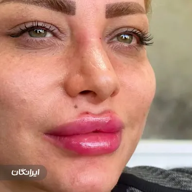 کلینیک زیبایی مون لایت