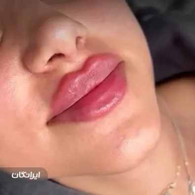 کلینیک زیبایی مهوان