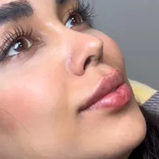 کلینیک زیبایی مهوان